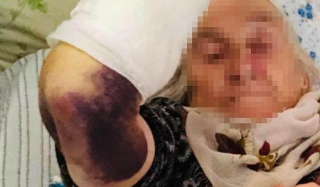 Eşi evde yokken kayınvalidesini sopayla darp etti