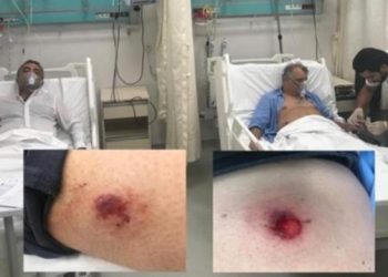 Suruç anmasına polis müdahalesi; milletvekilleri yaralandı