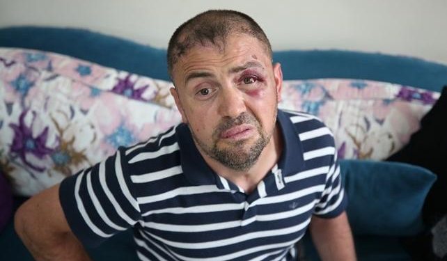 Bursa’da gazinin kafede darp edilmesi ile ilgili yeni gelişme