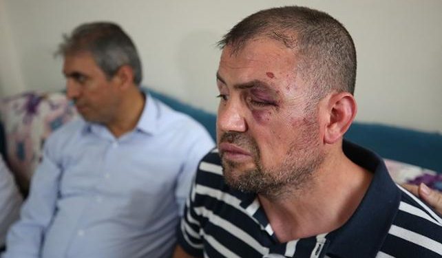 Gazi Ömür Karaman’a yapılan saldırıya malul gazilerden tepki