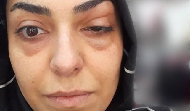 Gençleşmek istedi, gözünden oluyordu