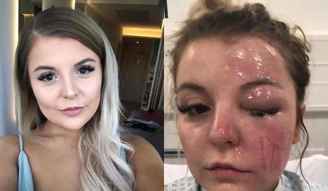 İnternette bulduğu tarifle pişirdiği yumurta neredeyse kör ediyordu